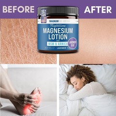 Magnesium Lotion MSM Arnica Lavender Nighttime Muscle Joint Body Cream 5 oz