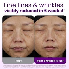 Reduces Fine Lines and Wrinkles in 6 weeks or Less, 50 Count (Pack of 1)