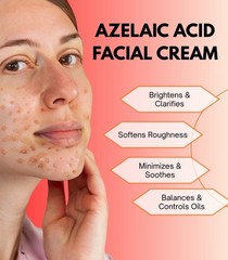 20% Azelaic Acid Face Cream Brightening Moisturizer for Uneven Skin Tone 30g