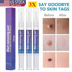 3X 5ML Skin Tag Remover Pen Skin Tag Mole Wart Dark Spot Remover Painless & Safe