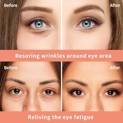Magic Eye Cream 28 seconds remove eye bags dark circles eye wrinkles Anti Aging
