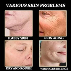 Japanese Qingling Polypeptide Firming Anti-Aging Cream Wrinkle Removal Cream