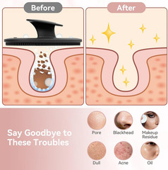 Silicone Face Scrubber 2 Pack, Manual Facial Cleansing Brush for Men and Women,