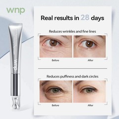 WNP Eye Cream|Wrinkle Eraser EyeCream, Multi-peptide Firming Eye Tightener, A…