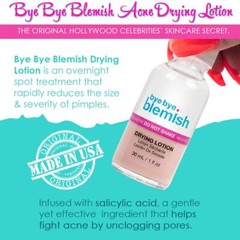 Bye Bye Blemish Acne Drying Lotion 2 Pack Fast Acting Pimple Treatment