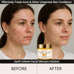 Turmeric Vitamin C Face Cream Glow Boosting Moisturizer Skin Repairing Antiaging