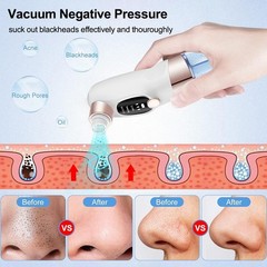 Ultra Pro Blackhead Remover Vacuum Electric Pore Cleaner Acne Black Dot Tool USB