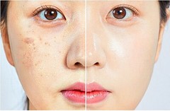 WHITESILK Retinaldehyde (4000ppm) & Bakuchiol Anti-Wrinkle SUPER Cream (30ml)