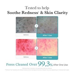 Advanced Medicube Azelaic Acid Niacinamide Deep Clean Foam Cleanser