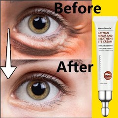 20g Eye Cream Remove Eyes Bags Dark Circles Anti Aging Eye Cream Serum Lift Firm