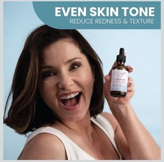 2xEva Naturals Azelaic Acid Serum for Face Niacinamide Hyaluronic Acid Vita ACE