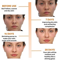 Samisha Vitamin C Face Serum Face Glowing &Whitening Pigmentation 30 ml