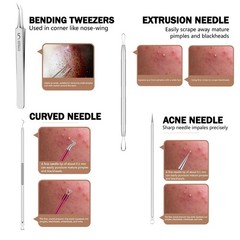 Blackhead Remover Pimple Popper Tool Kit 6 Pcs wan-6-piece, Silver