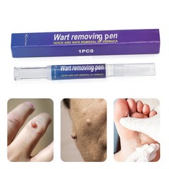 5X 5ml Warts Removal Pen Eliminate Wart Pen Wart Liquid Hand Foot Warts Remove