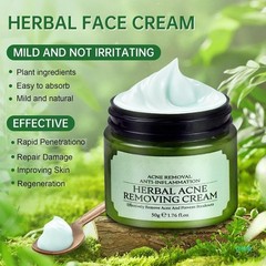 Natural Acne Removal Cream for Oily & Combination Skin | Clears Pimples & Pores