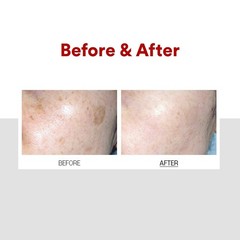 Revitalize Skin with Melanon X Cream – Brightening & Moisturizing 1.01 oz