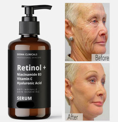Retinol, Niacinamide, Vitamin C, Hyaluronic Acid, AntiAging Wrinkle SERUM – 8oz