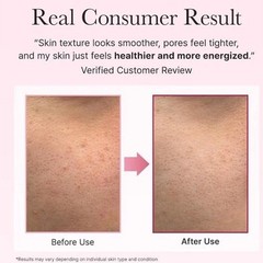 Arencia PDRN Booster Shot 30mL -PDRN + Peptides Renewing & Boosting K-beauty