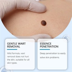 Tag & Spot Eraser Mole Skin Tags Removal Tool Eraser Pen Painless Long-Lasting