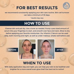 Foxbrim Naturals Vitamin C Face Serum 1oz – Stable Formula with Botanical Hya…