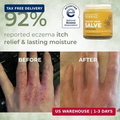 Ora&rsquo;s Amazing Herbal Touchy Skin Salve, Eczema Cream for Kids and Adults, Natura