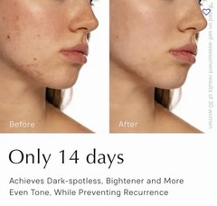 Dark Spot Correcting Serum