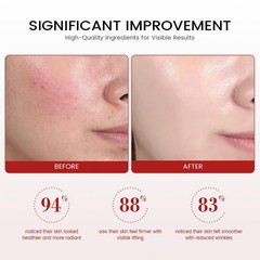 Koriderm Time Reverse Cream, Koriderm Cream Skin Face for All for Types-50ml
