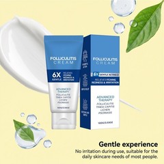 Folliculitis Treatment Cream: Effective Treatment for Folliculitis Scalp