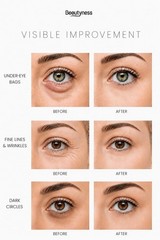 Instant Ageless Eye Cream – Anti Wrinkle Cream, Removes 0.5 Fl Oz (Pack of 1)