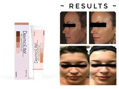 Skin Lightening Cream Extra Strength Lighter FAST Result-NO SIDE EFFECTS – 20GM