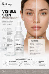 The Ordinary Niacinamide 10% Zinc 1% Serum Acne Oil Control Skin Care