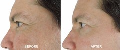 20% Glycolic Acid Collagen Rebuild Cream w/ Argireline, M3000, CoQ10, Retinol