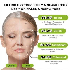 Rolimey Vita-A Retinol Skin Cream, Smoothing Daily Firming Care