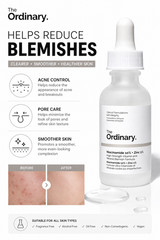 The Ordinary Niacinamide 10% Zinc 1% Serum Acne Oil Control Skin Care