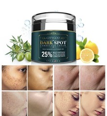 CITYGOO Dark Spot Remover for Face: Dark Spot Corrector Cream – Enriching Skin