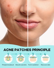 TKTK Pimple Patch Acne Patch, 4 Sizes 280 Patches Acne Absorbing Cover Patch, Hy
