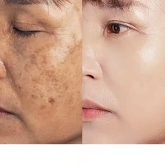 Niacinamide 10% Facial Serum Skin Brightening Dark Spots Eraser, 30ml [USA Stock