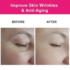Organic Rosehip Seed Oil for Face, USDA Certified, Cold Pressed, Unrefined, 100%