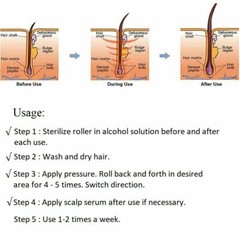 0.5mm Derma Roller Hair Beard Regrowth & Skin Rejuvena 540 Titanium Micro Needle