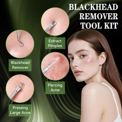 Blackhead Remover Mask, Charcoal Peel off Face Mask 3.53Oz, Black Head Remover f