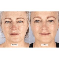 CurrentBody Skin LED Light Therapy Mask Series 2 – New Open Box