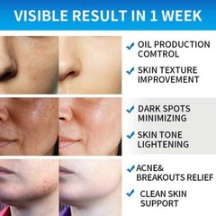 Glycolic Acid 35% Facial Exfoliating Peel Pads AHA Green Tea – 50 pads USA Stock