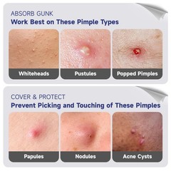 Dazzlook Cute Pink Heart Pimple Patch 0.21 Count (Pack of 48), Multicolored