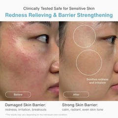 AROOM Barrier Repair Cream with Panthenol Ceramide | Damaged Skin Restore an…