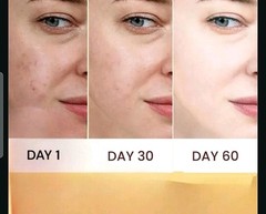 Niacinamide 10% Facial Serum Skin Brightening Dark Spots Eraser, 30ml [USA Stock