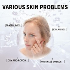 Qingling Face Cream, Quinglin Crema Para Arrugas, Qingling Wrinkle Removal Cream