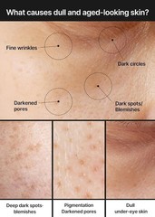 Pore + Dark Spot Brightening Cream 35ml | Niacinamide and Tranexamic Acid – 3pcs