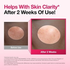 Koek Niacinamide 10% + TXA 4 Dark Spot Correcting Serum 30ml