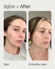 Topicals Faded Brightening and Clearing Serum | Reduces Discoloration, Post-Blem