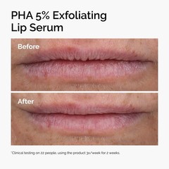 The Ordinary PHA 5% Exfoliating Lip Serum Hydrating Treatment 0.5 oz